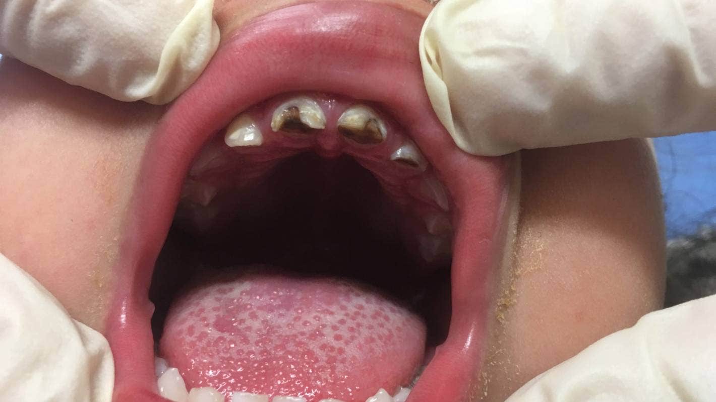 NZDA Sugary Drinks Spokesperson Dr Rob Beaglehole calls out Coke